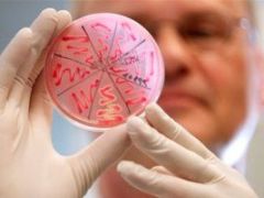 Клебсиелла окситока: что это за бактерия и нужно ли с ней бороться?