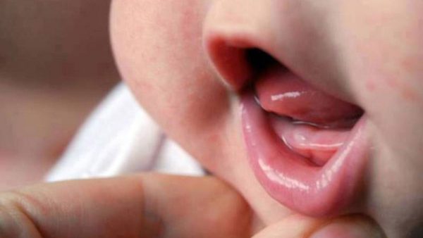 сколько дней температура при прорезывании зубов у детей