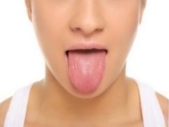 Глоссалгия языка: необходимо ли лечение?