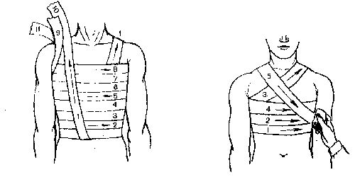 Порядок выполнения повязок на грудь