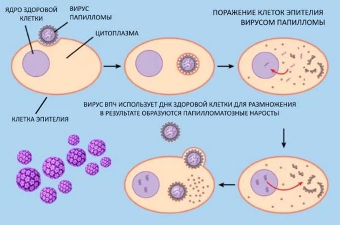 Схема заражения папилломавирусом