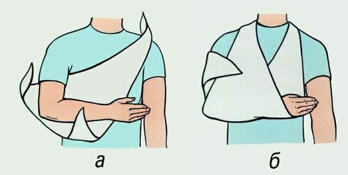 Первая помощь при травме плеча