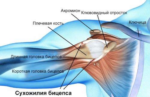 Разрыв сухожилия плечевого пояса