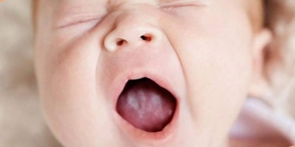 белый налет на языке и температура у ребенка